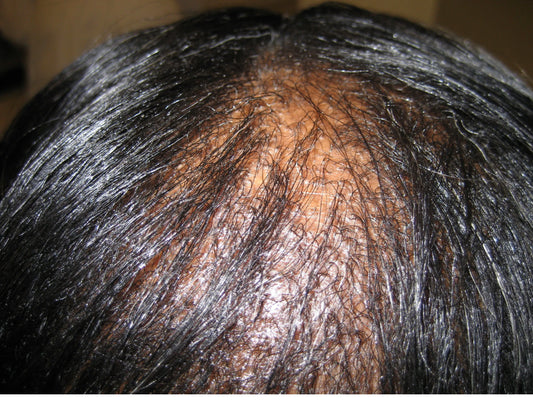 Benefits of a Scalp Message
