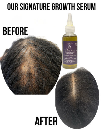The All-Natural Hair Growth Solution by SS Hair Care®